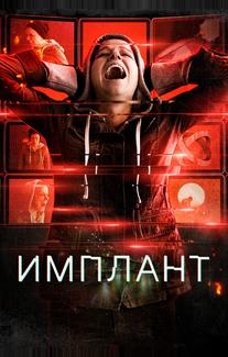 Имплант