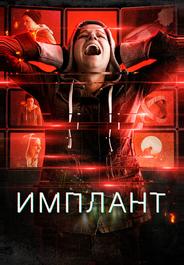 Имплант