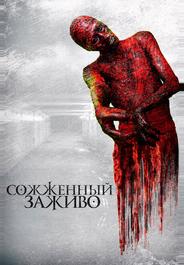 Сожженный заживо