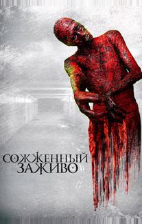 Сожженный заживо