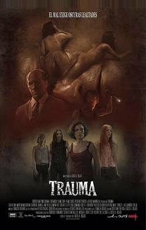 Травма